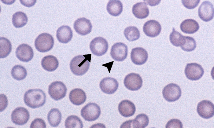 Torocytes 1 (Canine 1 - DIC) ARROWS