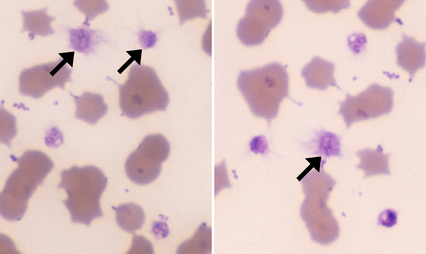 Activated Platelets 2-3 (Feline 2-3 - Hemobartonella) ARROWS