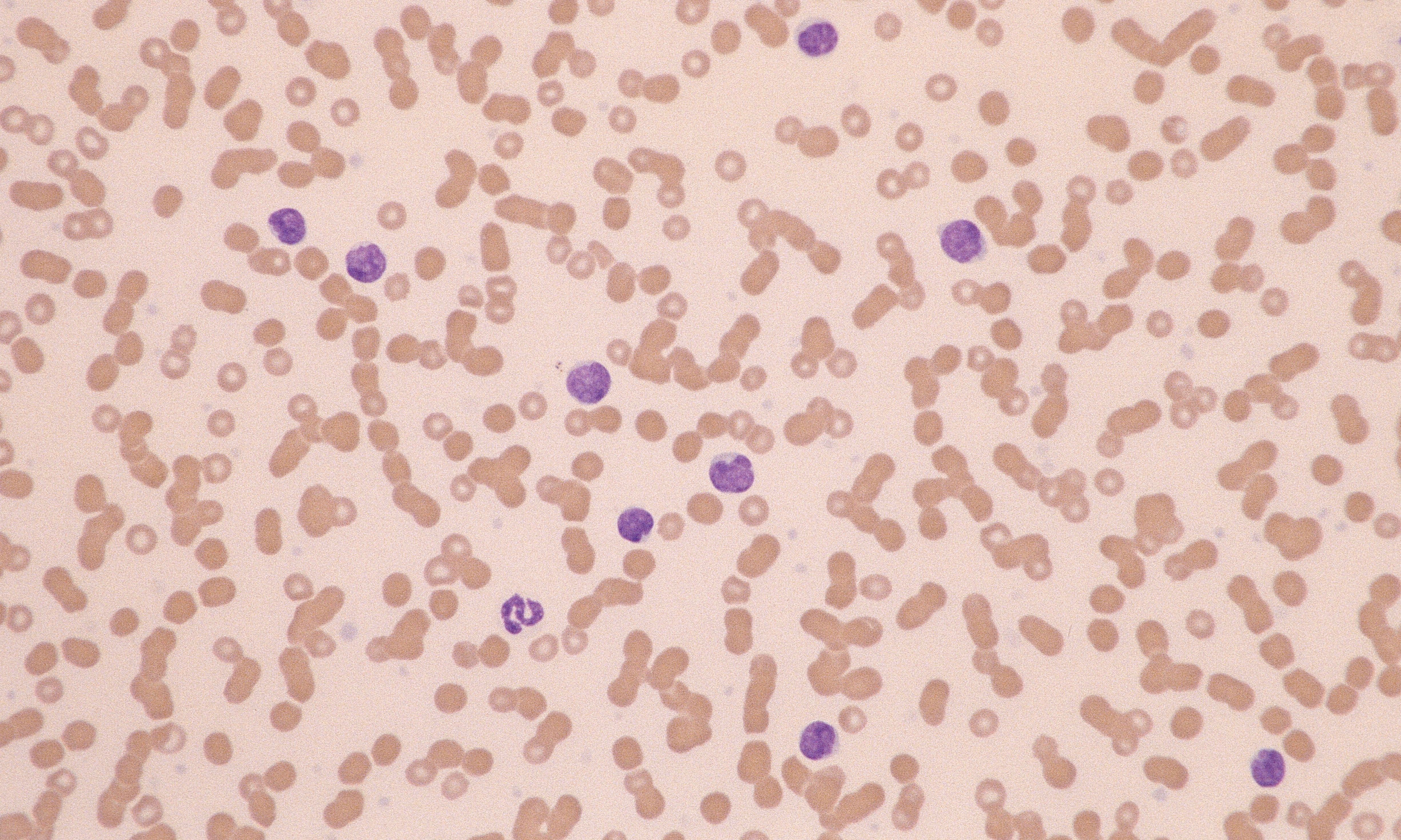 CLL 1 (Canine 1)