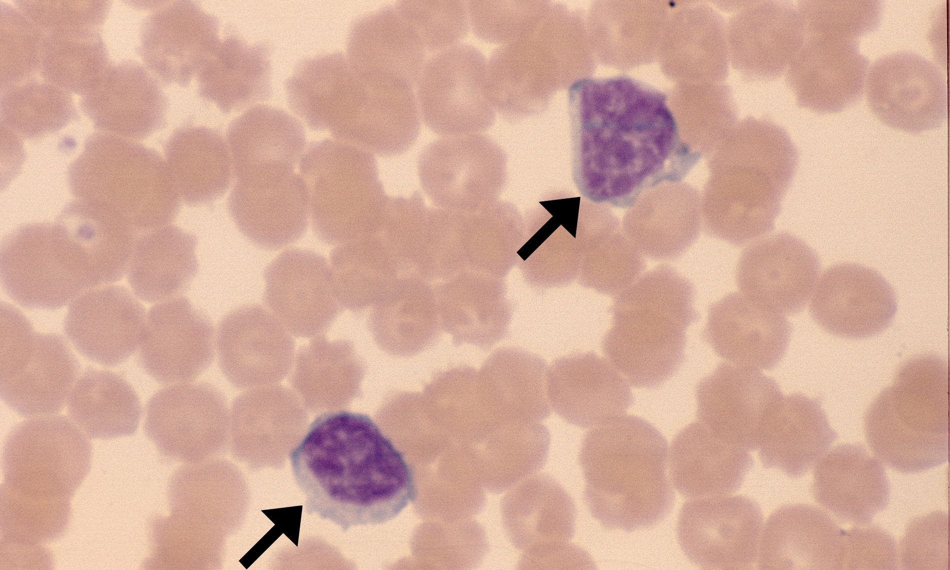 CLL 2 (Canine 2) ARROWS