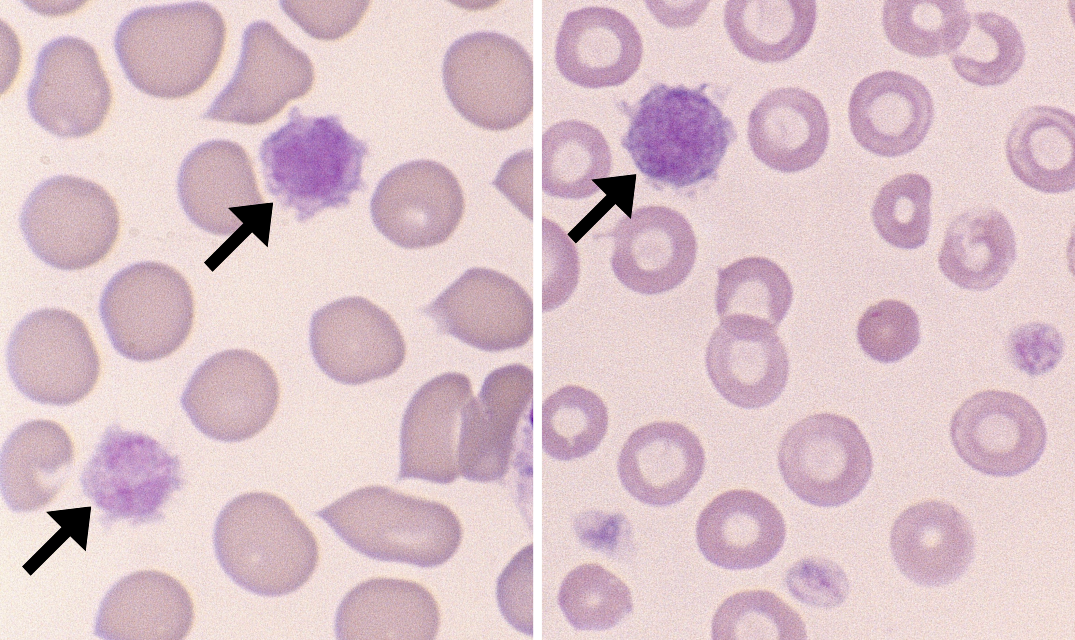 Giant Platelets 1-2 (Canine 1-2) ARROWS