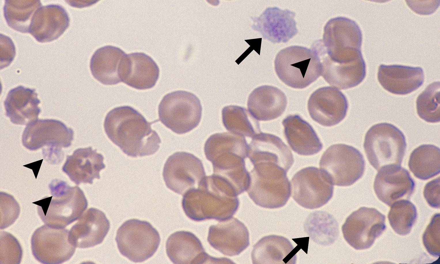 Giant Platelets 4 (Canine 4 - DIC) ARROWS