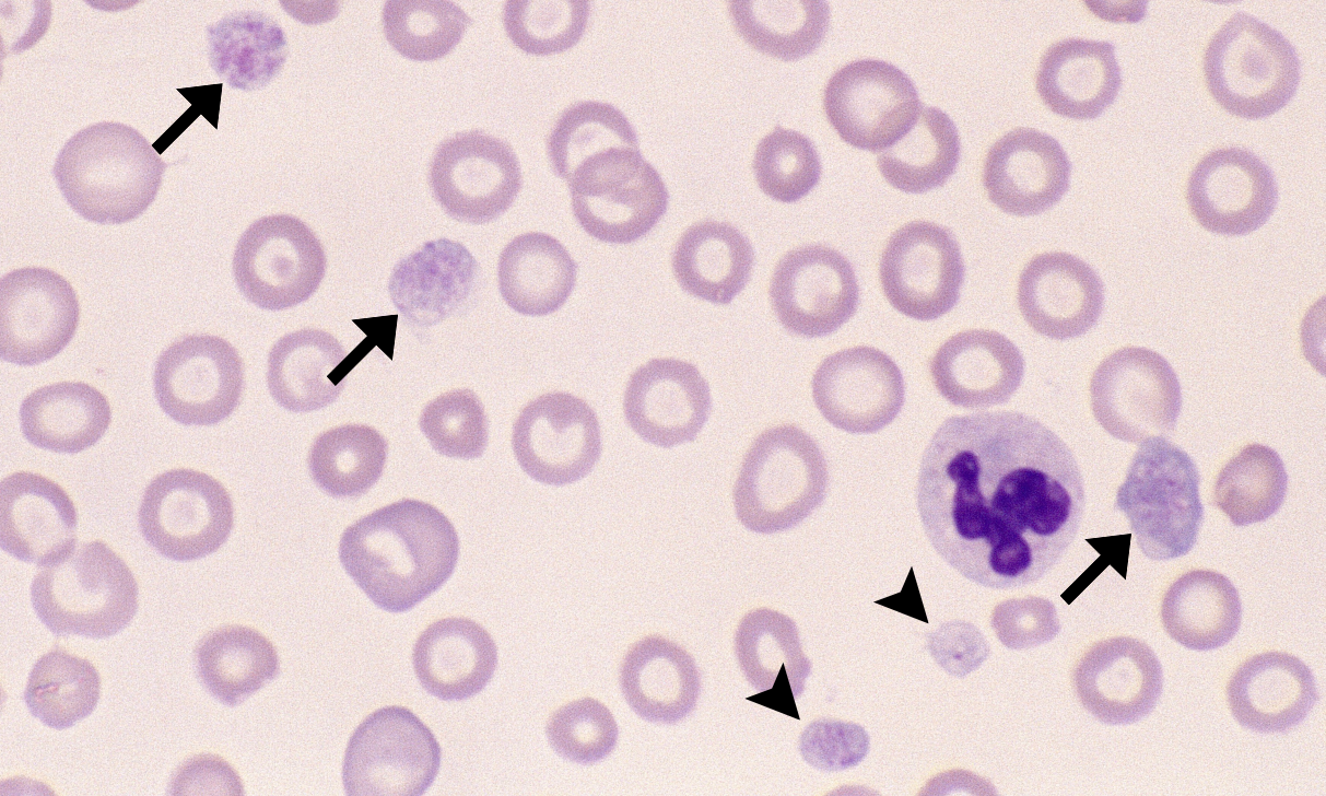 Giant Platelets 5 (Canine 5 - Hypochromic Microcytic Anemia) ARROWS
