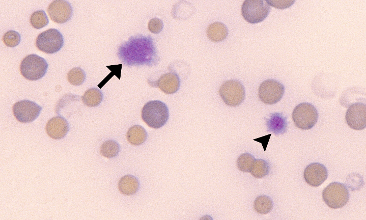 Giant Platelets 7 (Feline 1 - IMHA) ARROWS