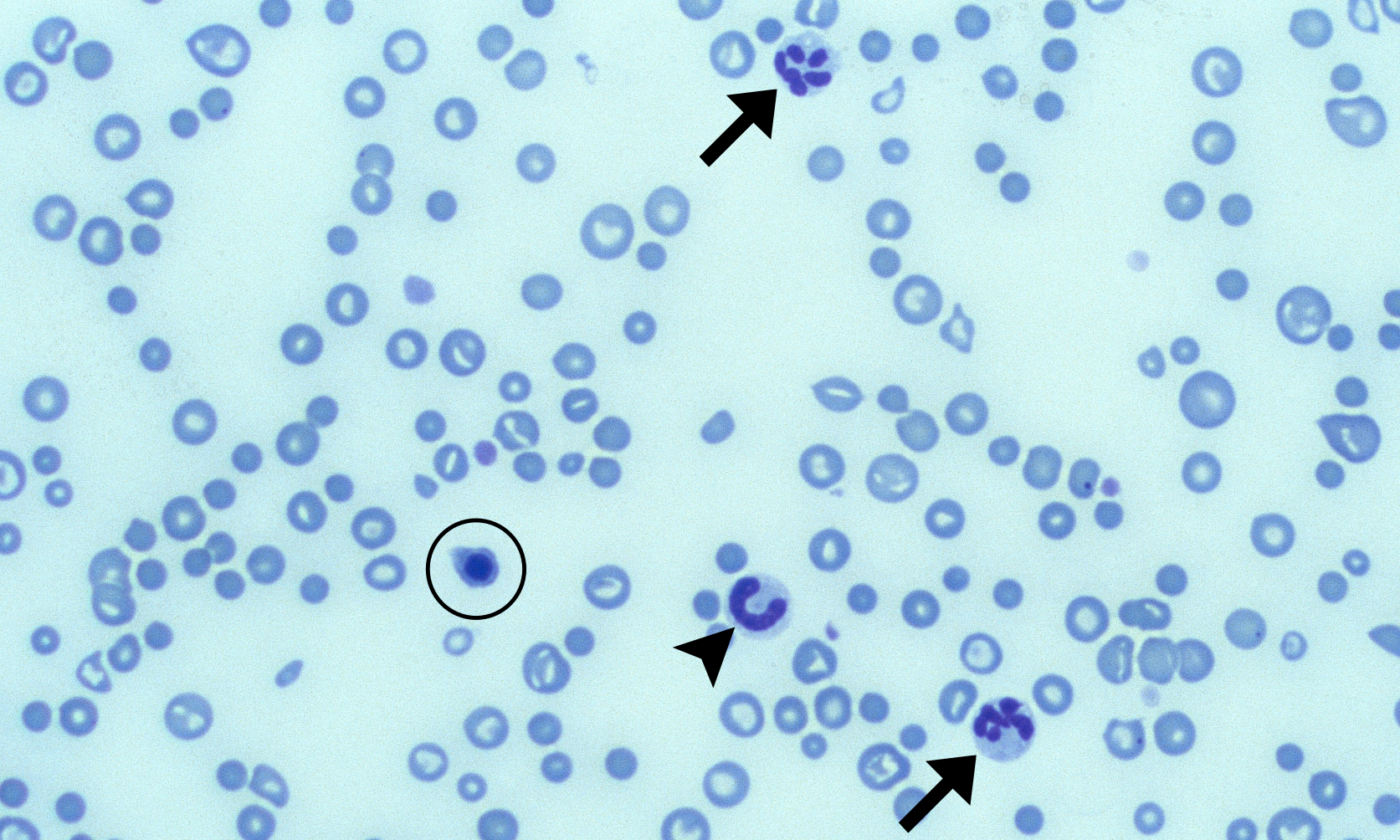 Neutrophils 12 (Canine 4 - Regen Anemia) ARROWS