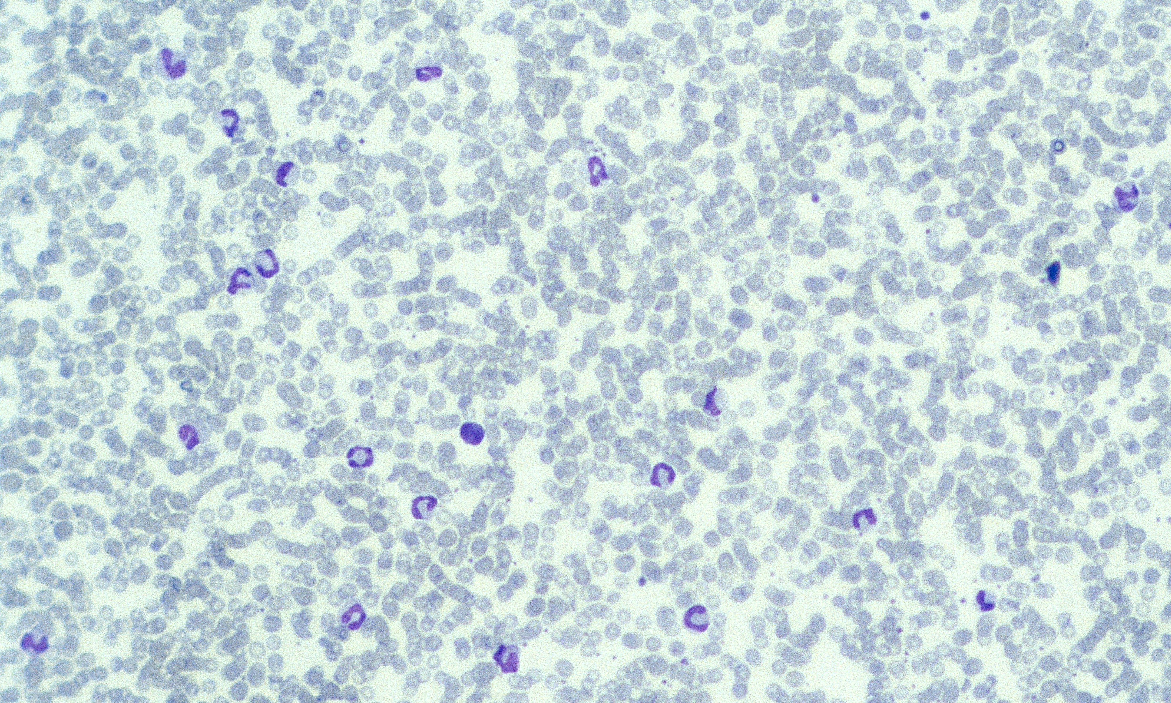 Neutrophils 15 (Canine 6 - Neutrophilia)