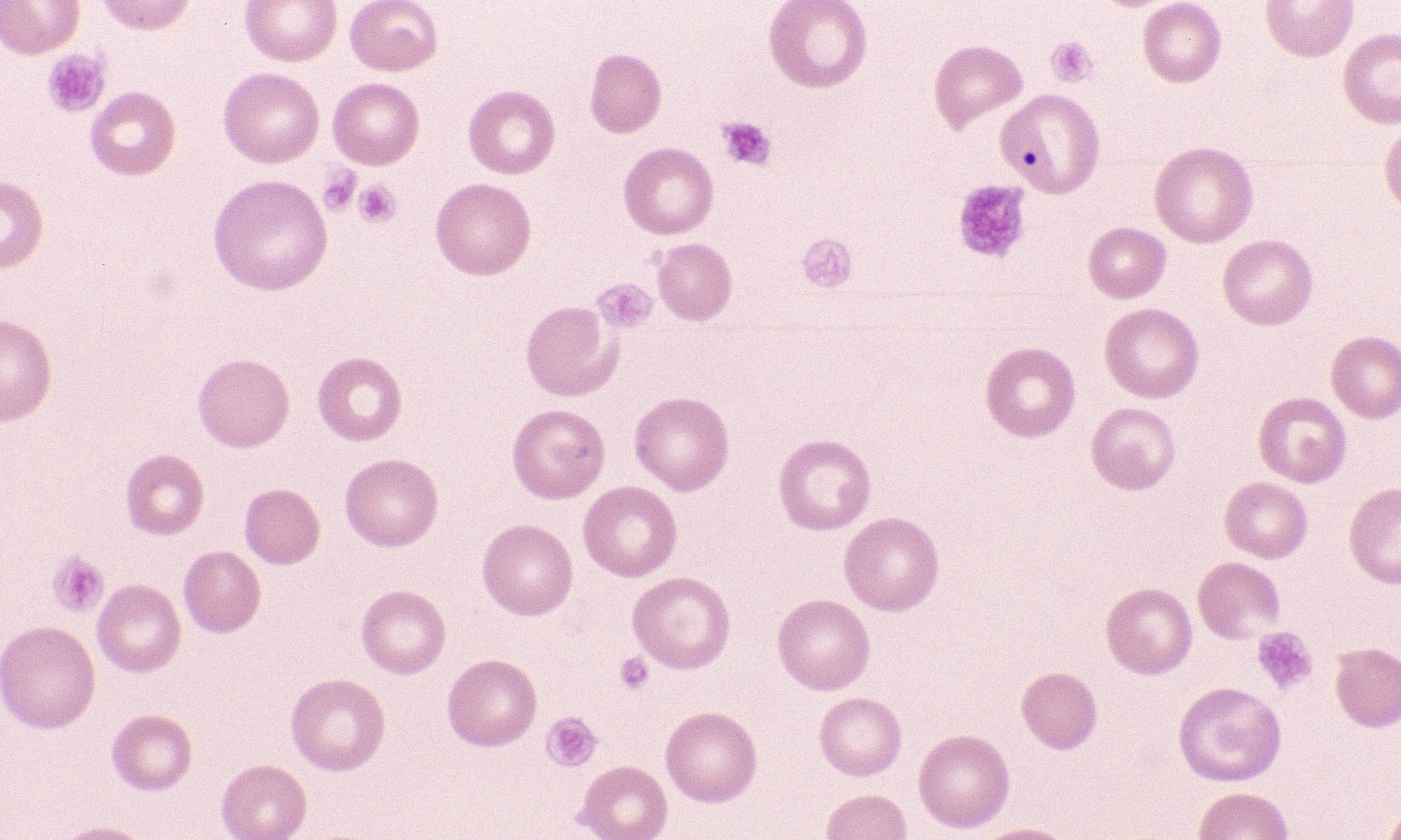 Platelets 1 (Canine 1 - Macrocytic Normochromic Anemia)