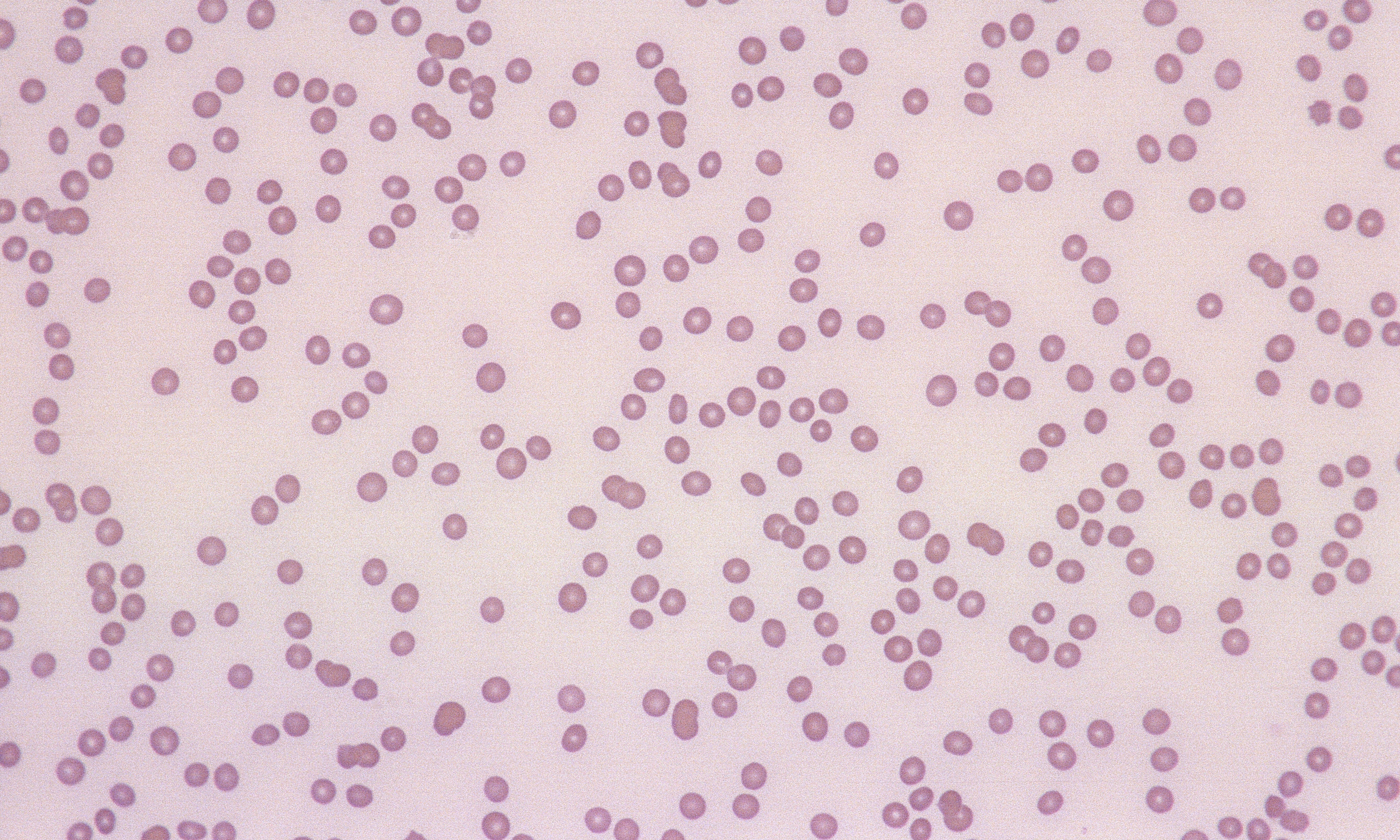 Platelets 10 (Canine 4) - Thrombocytopenia