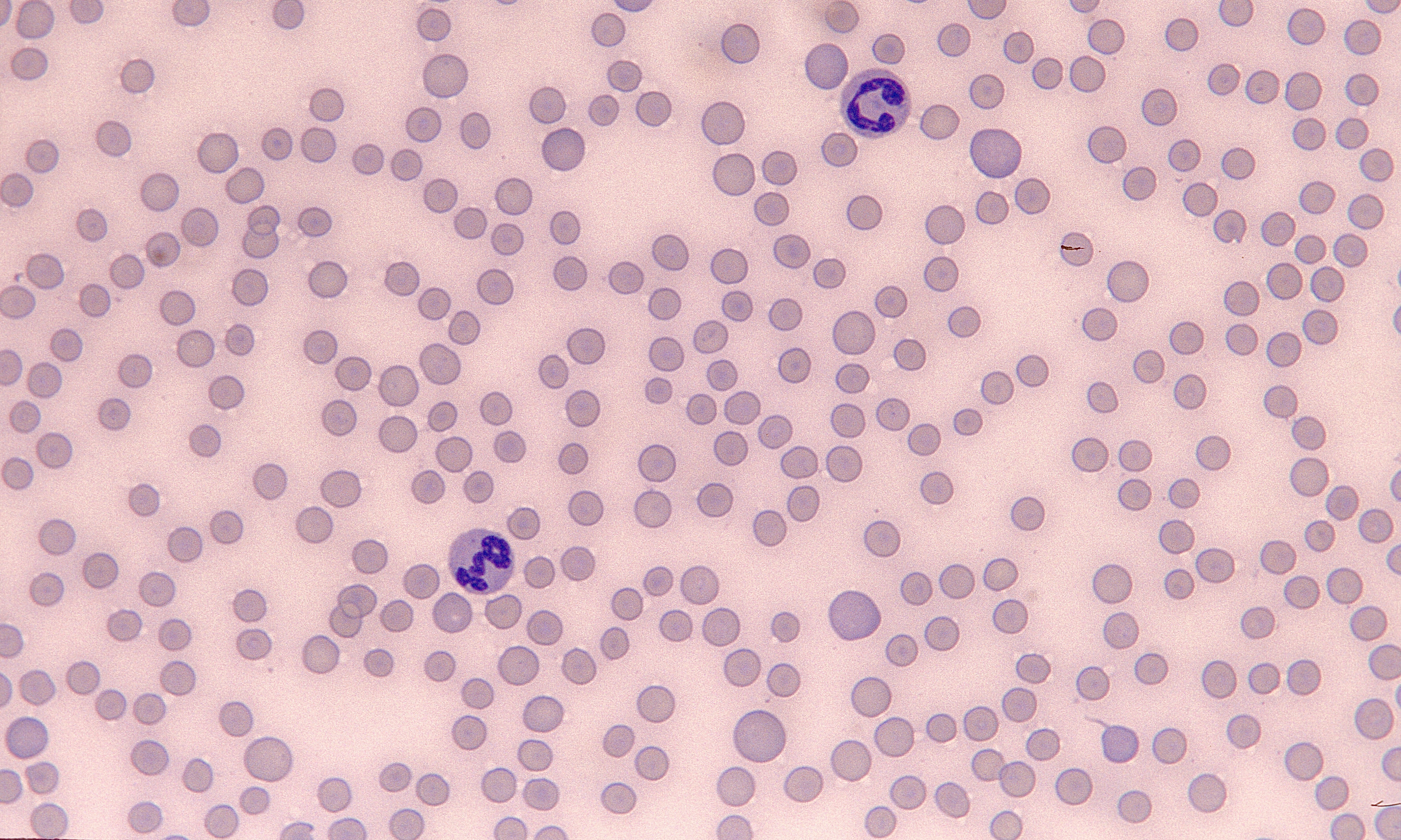 Platelets 11 (Feline 3) - Thrombocytopenia