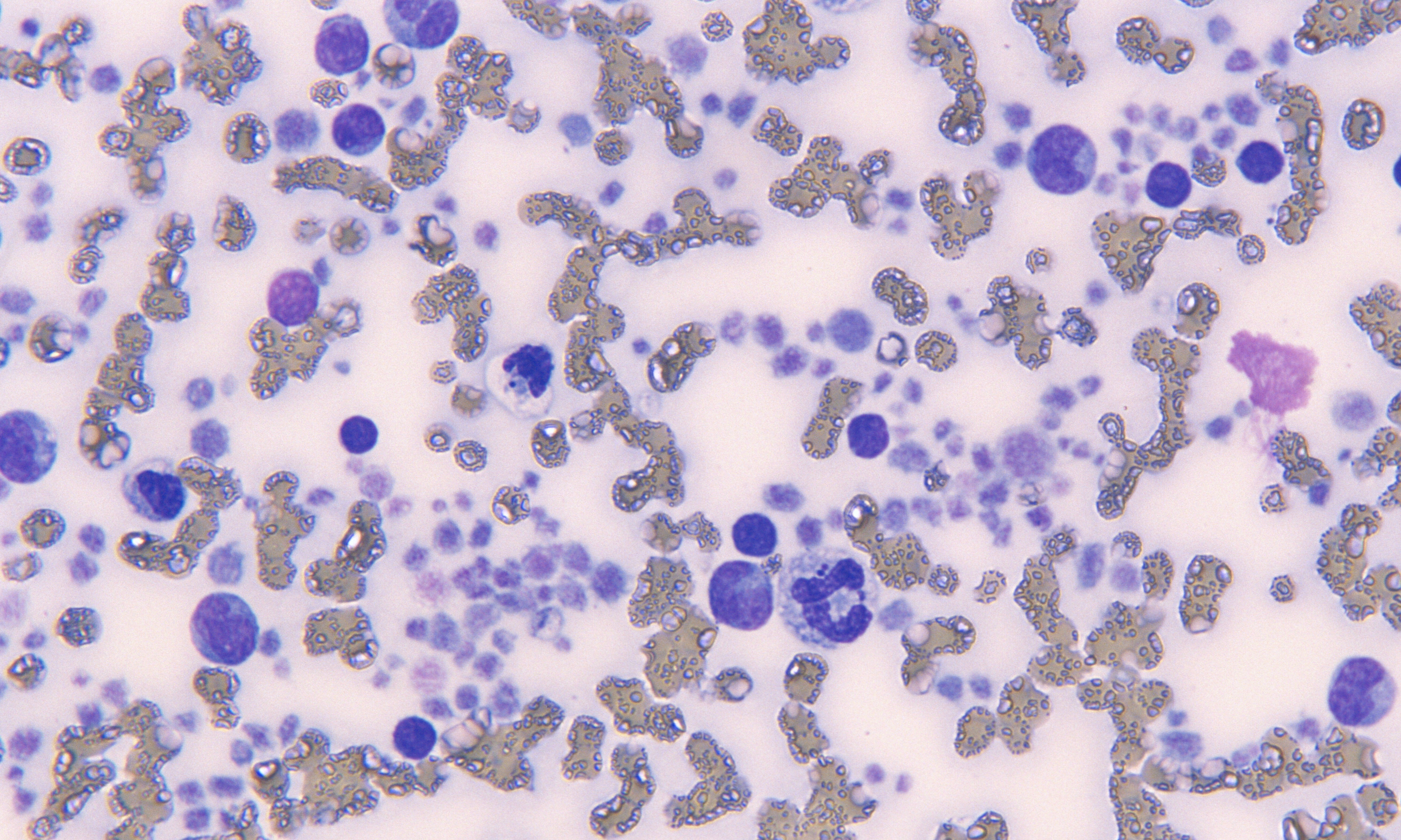 Platelets 14 (Feline 5 - Sepsis) - Thrombocytosis