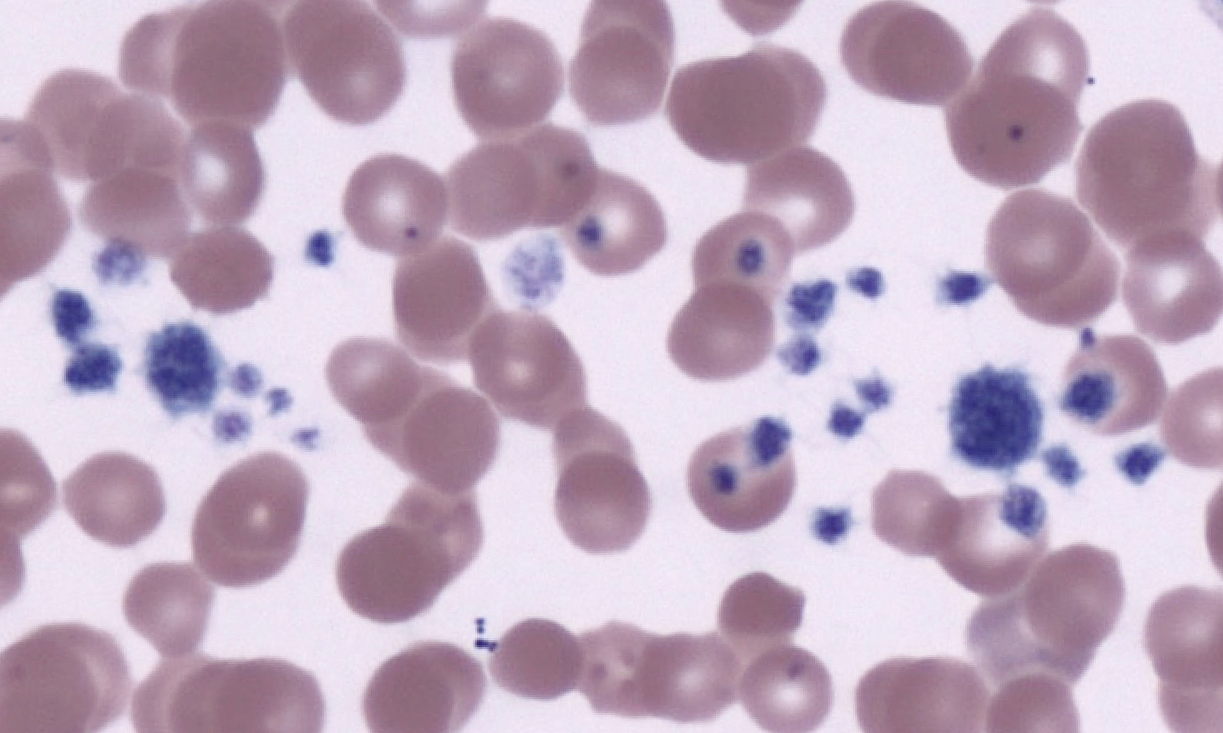 Platelets 15 (Feline 6)