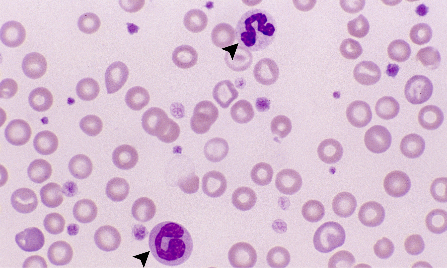 Platelets 2 (Canine 2) ARROWS