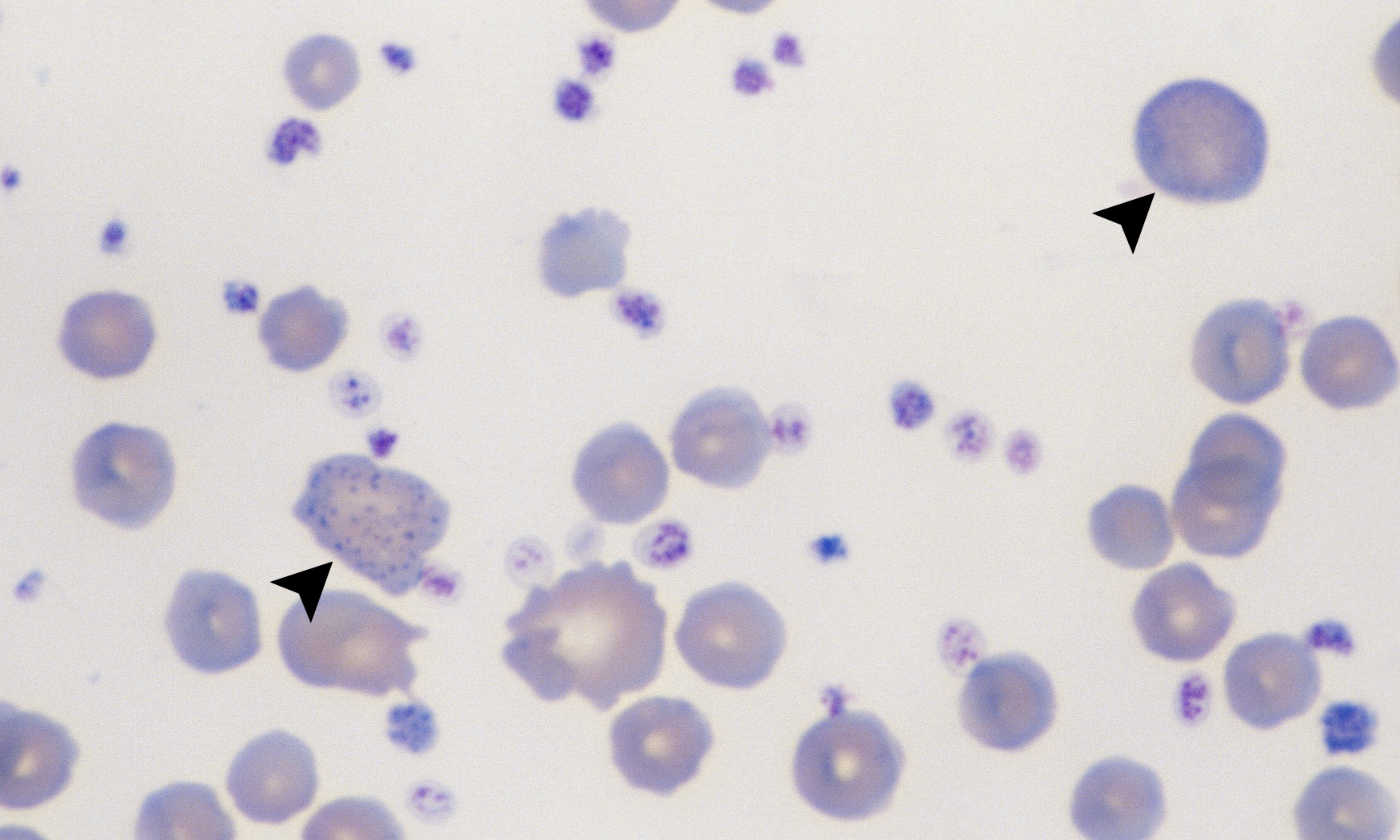 Platelets 4 (Bovine 1 - Sweet Clover Toxicity) ARROWS