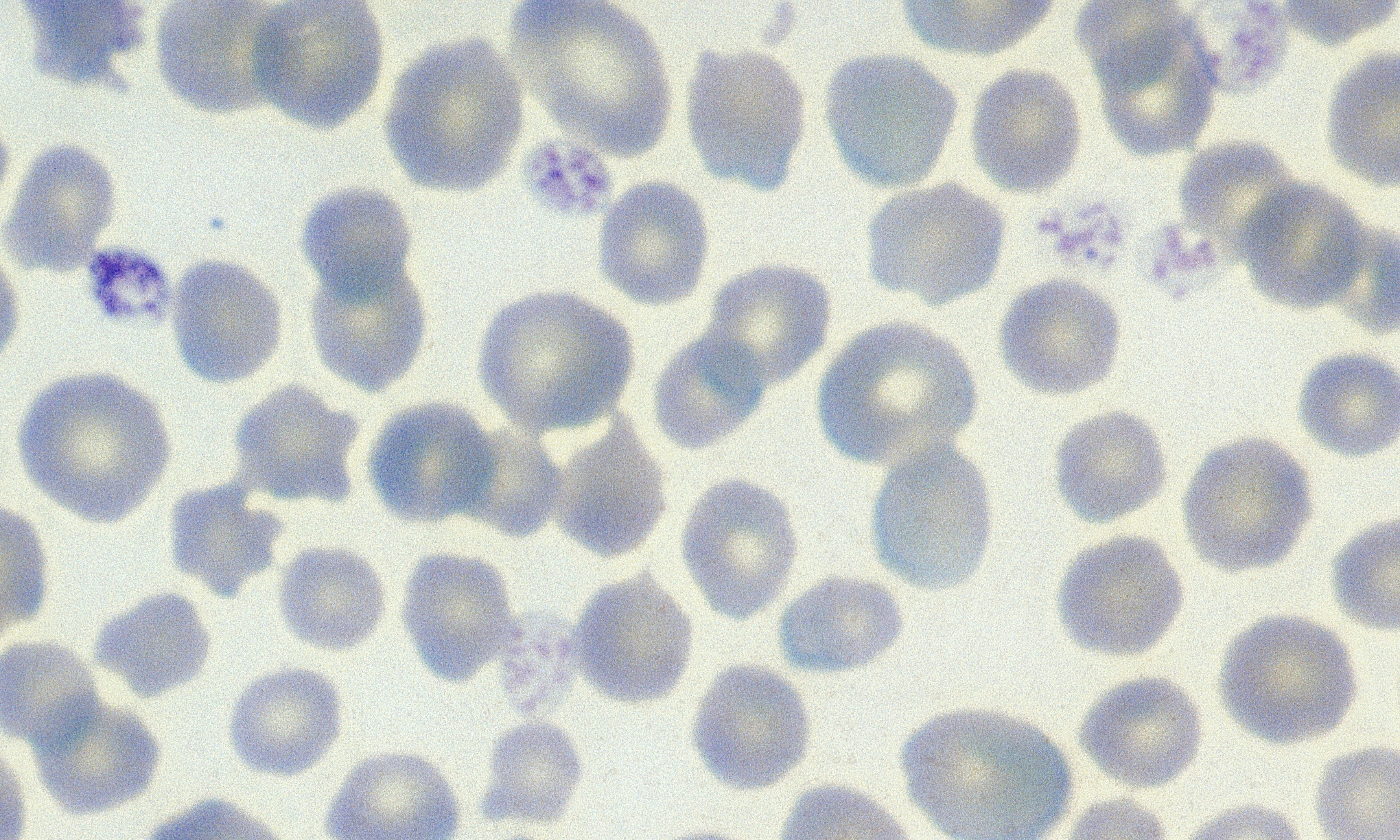 Platelets 5 (Bovine 2)
