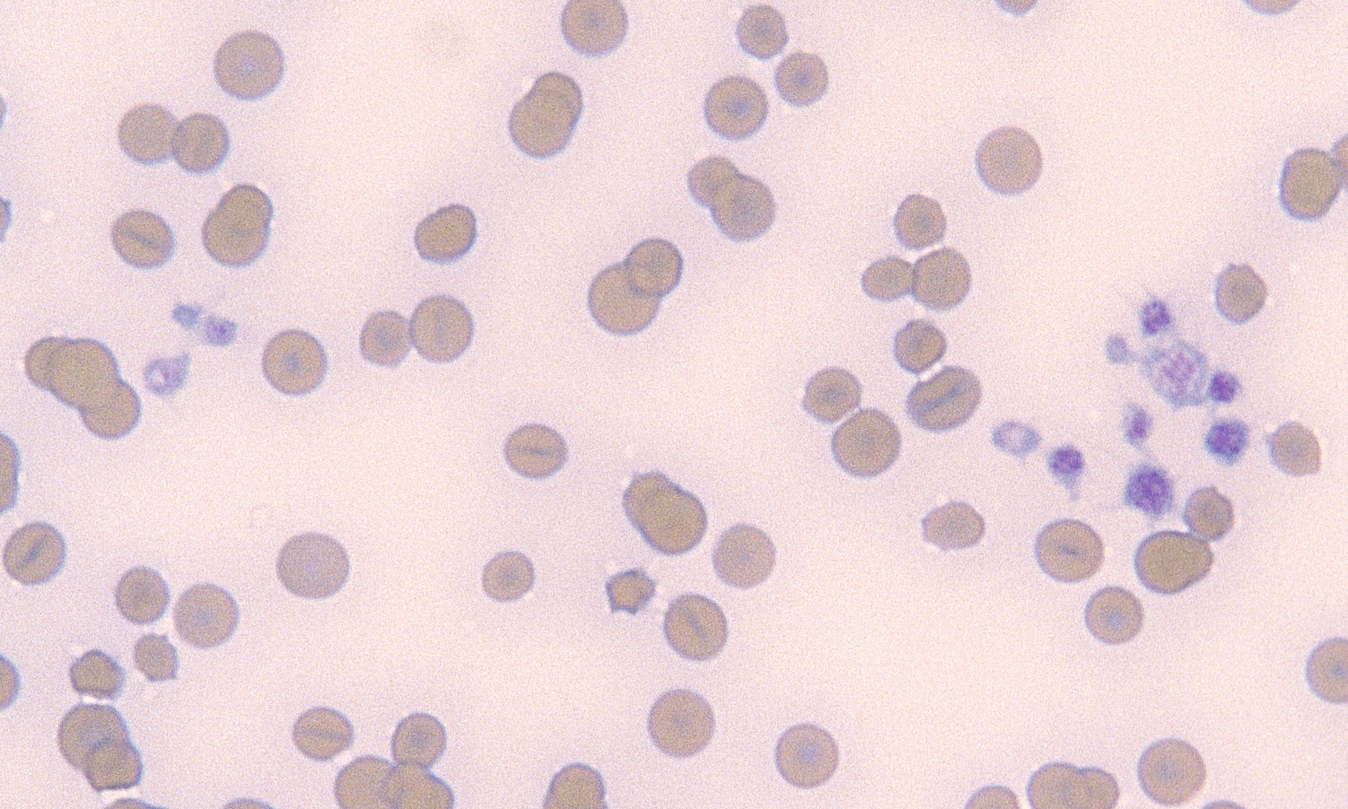 Platelets 7 (Feline 1)