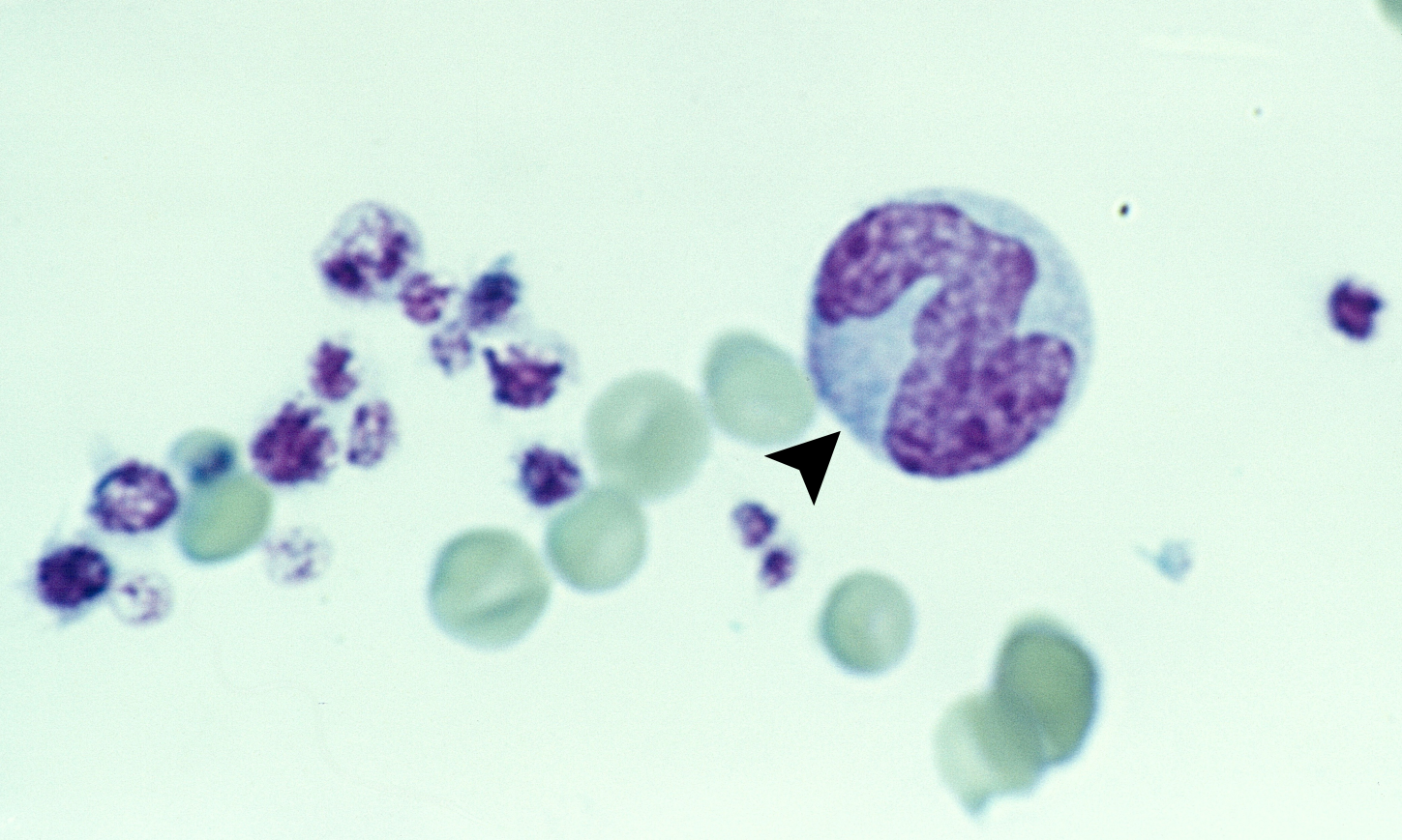 Platelets 8 (Feline 2) ARROWS