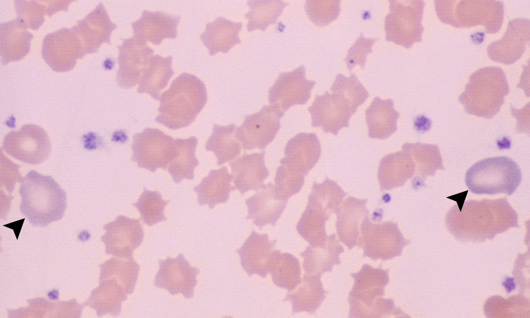 Platelets 9 (Porcine 1) ARROWS